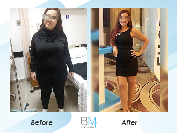 Advanced bmi Weight loss before and after 4