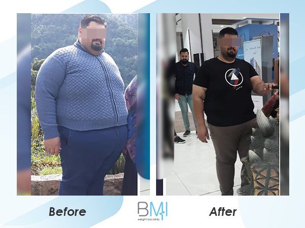 Advanced bmi Weight loss before and after 5