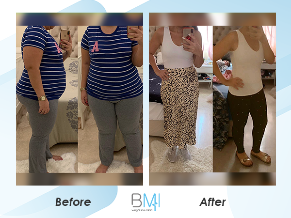 Advanced bmi Weight loss before and after 7