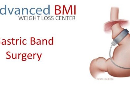 Gastric band surgery with Dr Nagi Safa