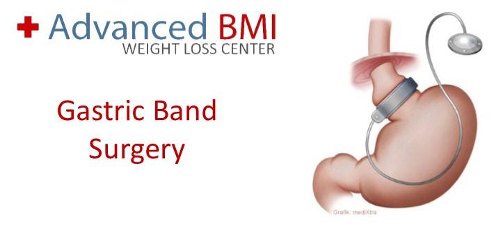 Gastric band surgery with Dr Nagi Safa