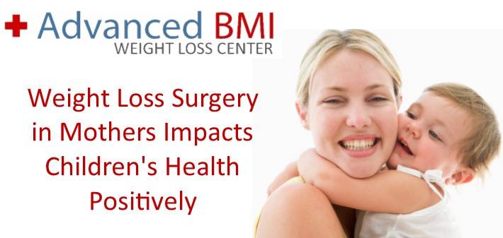 Weight Loss Surgery in Mothers