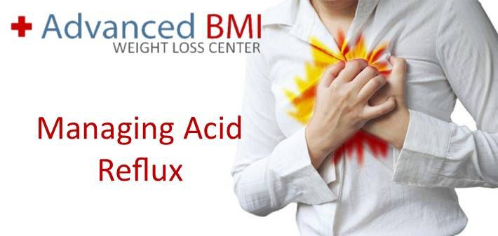 Managing Acid Reflux