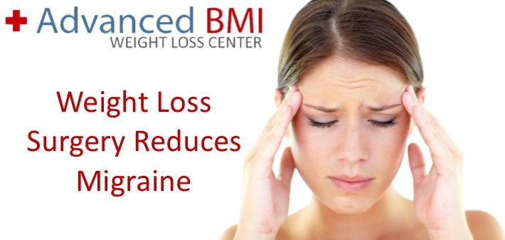 Weight Loss Surgery Reduces Migraine