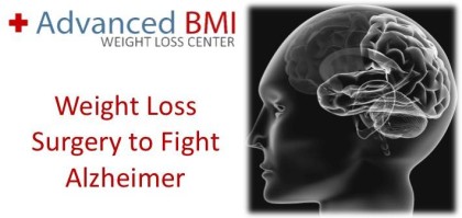 Weight Loss Surgery to Fight Alzheimer