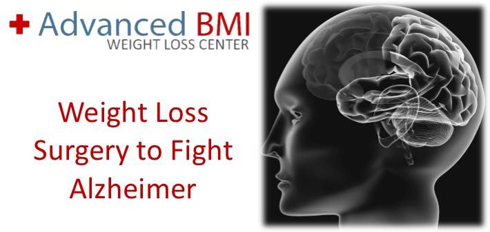 Weight Loss Surgery to Fight Alzheimer