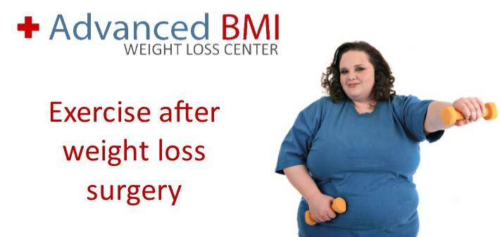 Exercise after weight loss surgery