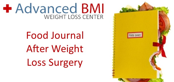 Food Journal After Weight Loss Surgery