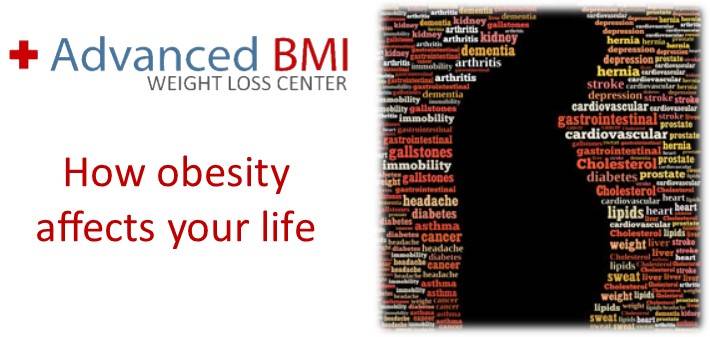 How obesity affects your life