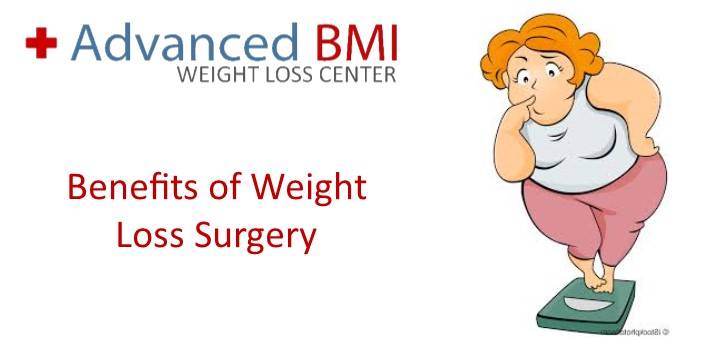 Benefits of Weight Loss Surgery