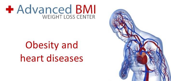 Obesity and heart disease