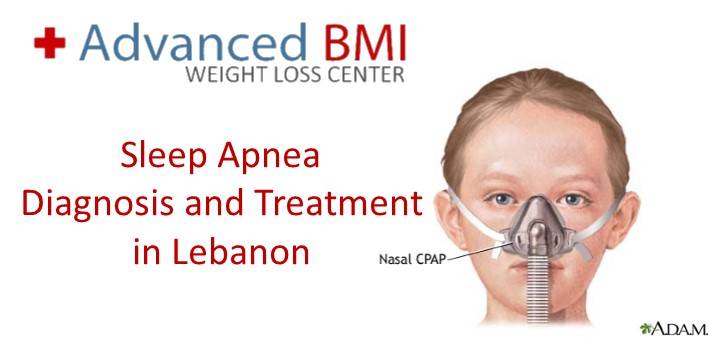 Sleep Apnea - Diagnosis and Treatment in Lebanon