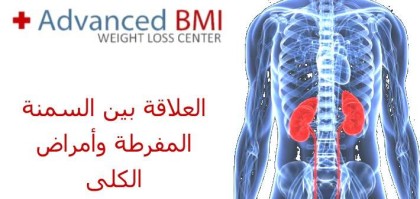 العلاقة بين السمنة المفرطة وأمراض الكلى