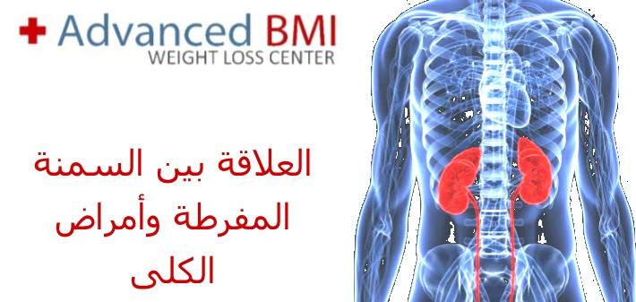 العلاقة بين السمنة المفرطة وأمراض الكلى
