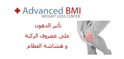 تأثير الدهون على غضروف الركبة و هشاشة العظام