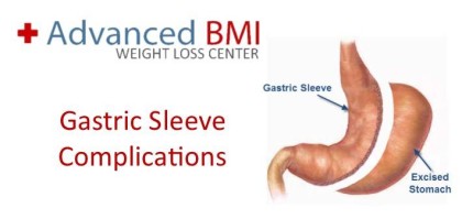 Gastric Sleeve Complications in Lebanon