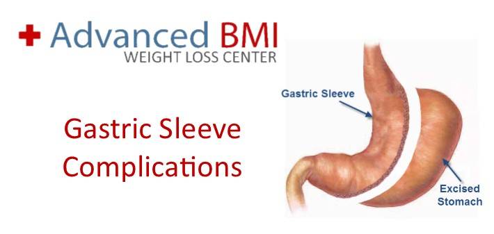 Gastric Sleeve Complications in Lebanon