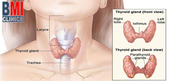 Is your thyroid gland making you fat - Advanced BMI Lebanon