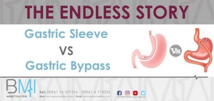 Gastric Sleeve Vs Gastric Bypass Surgery in Lebanon - Dr Nagi Jean Safa