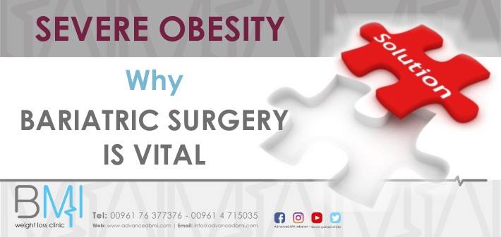 Severe Obesity Why Bariatric Surgery is Vital