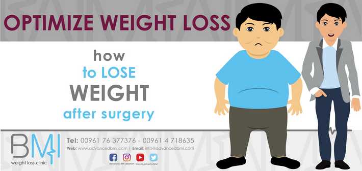 Optimize Weight Loss after Bariatric Surgery