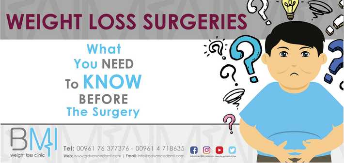 What You Need to Know before Weight-loss Surgeries