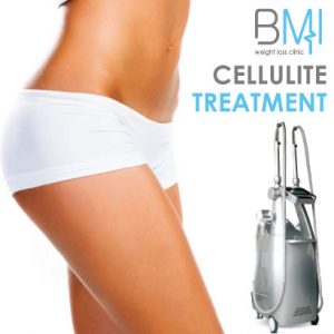 Cellulite Treatment – Ultrasonic Cavitation – Velashape