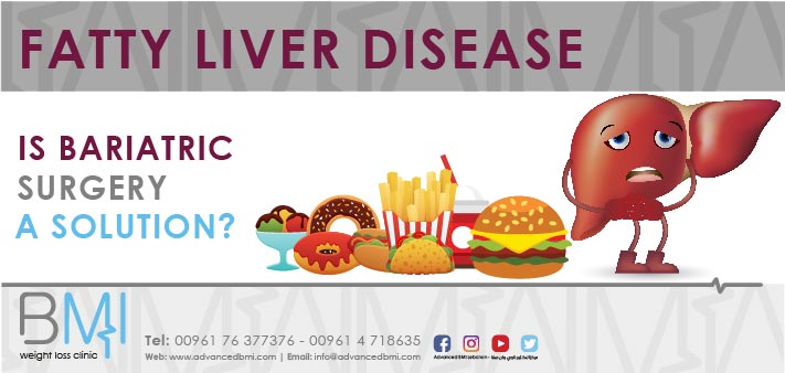 Fatty Liver Disease