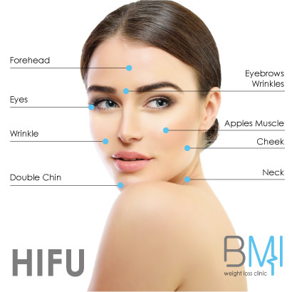 HIFU - HIFU Skin Tightening 